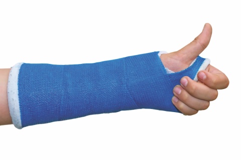 An arm giving a thumbs up despite being in a blue cast.